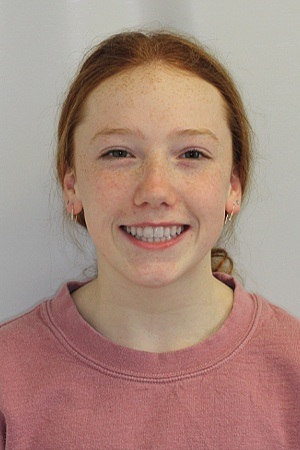 Teen girl with perfected smile after orthodontic treatment