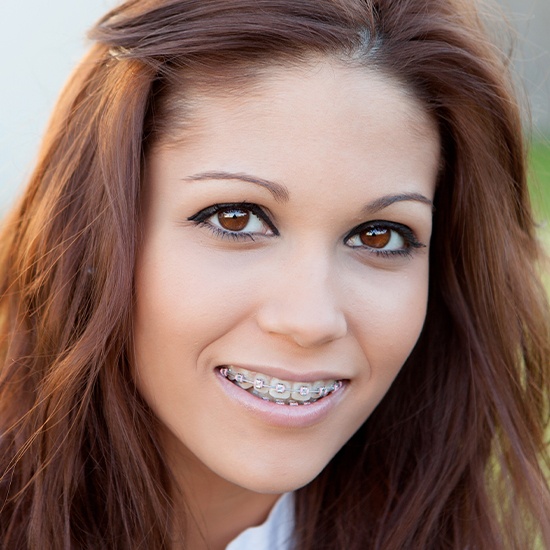 Woman smiling with adult orthodontics