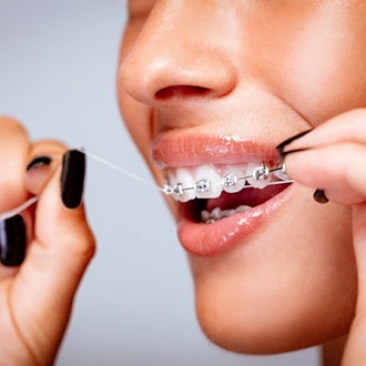 An up-close view of a person using dental floss to clean around their brackets and wire