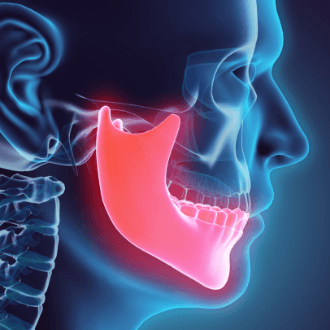 Animated jaw and skull bone planning dentofacial orthopedic treatment
