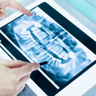 New Hampshire orthodontist reviewing patient's X-ray