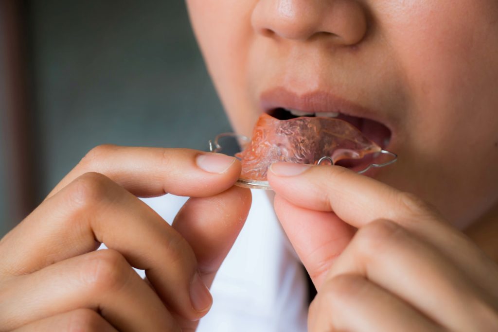 Patient putting pink orthodontic retainer in mouth