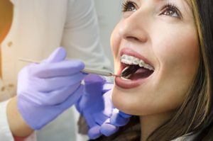 a patient with braces smiling 