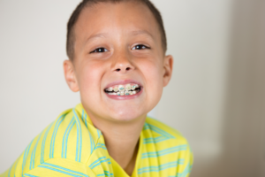 a child with braces smiling